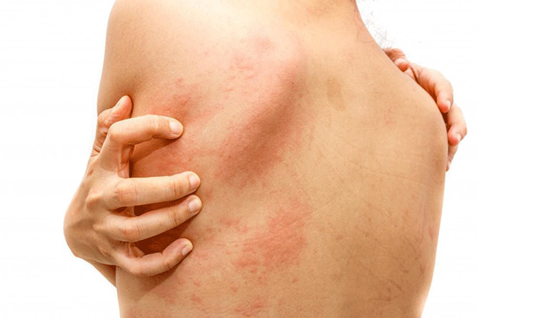 Phải giặt đồ mới mua trước khi mặc