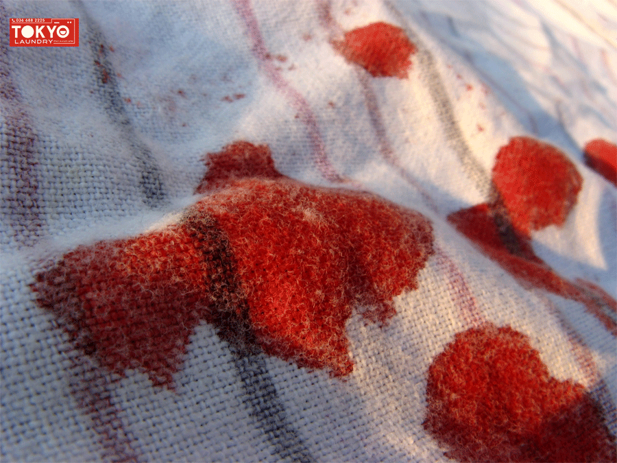 loại bỏ vết máu trên quần áo